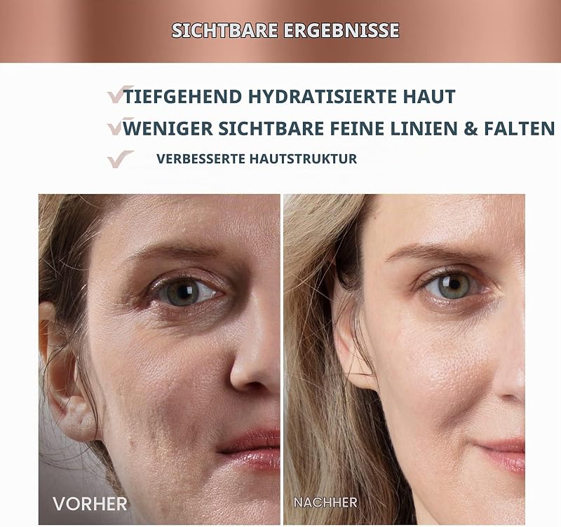 SUPERCHARGED HA+PGA Intensive Feuchtigkeitscreme mit 3x Wirkung – Anti-Falten tagescreme gesicht– Hyaluronsäure & Squalan – Vitamin E -Vegan Kosmetik – Gesichtscreme Männer und Damen – 50 ml