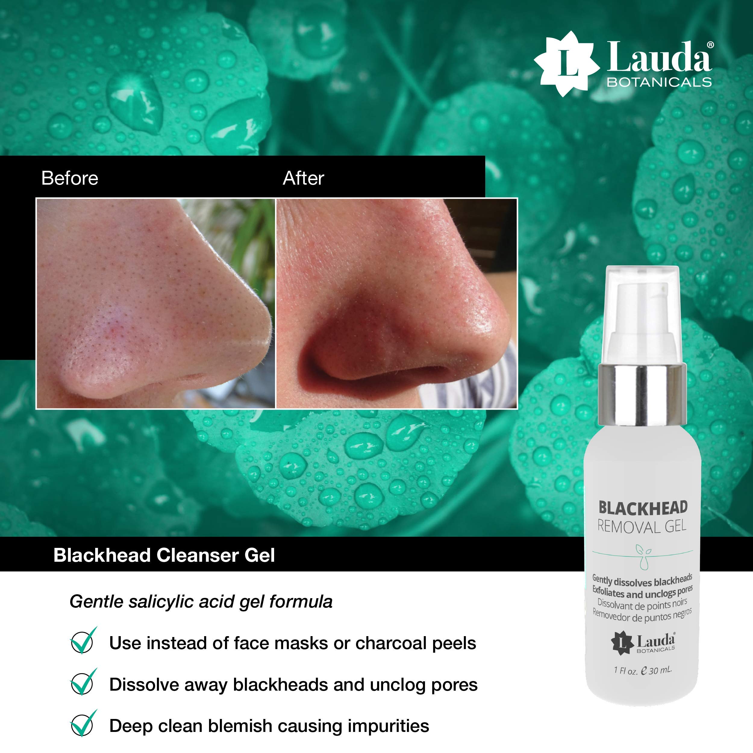 Blackhead Remover Cleanser with Salicylic Acid, Blackhead Eliminator & Dissolving Gel, 1 Ounce