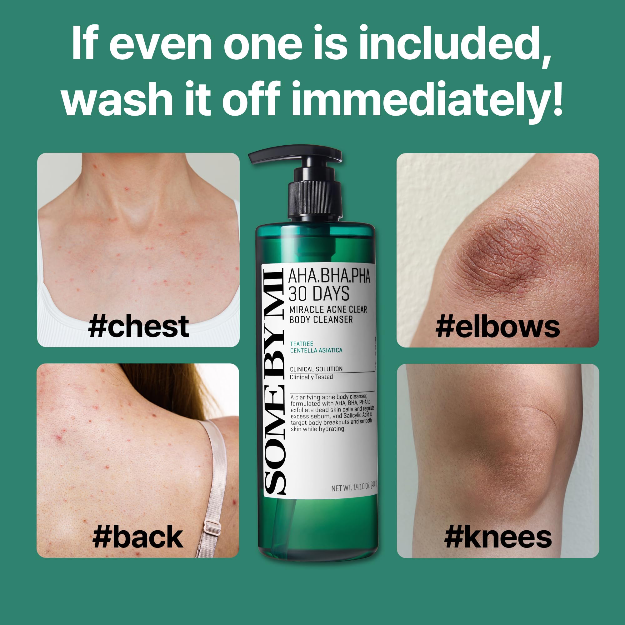 SOME BY MI AHA BHA PHA 30 Days Miracle Acne Clear Body Cleanser – 13.5oz, 400ml – Daily Exfoliating Tea Tree & Salicylic Acid Acne Body Wash – Deep Cleanses Sebum, Oil & Impurities – Korean Skin Care