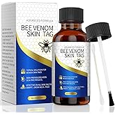 TWICETWO Fast-Acting Bee Venom Skin Tag Remover, Innovative Bee Venom and Salicylic Acid Formula, Easy Action, Permanent Results,Natural, Gentle, and Fast Removal of Skin Tag from The Body(30ML)