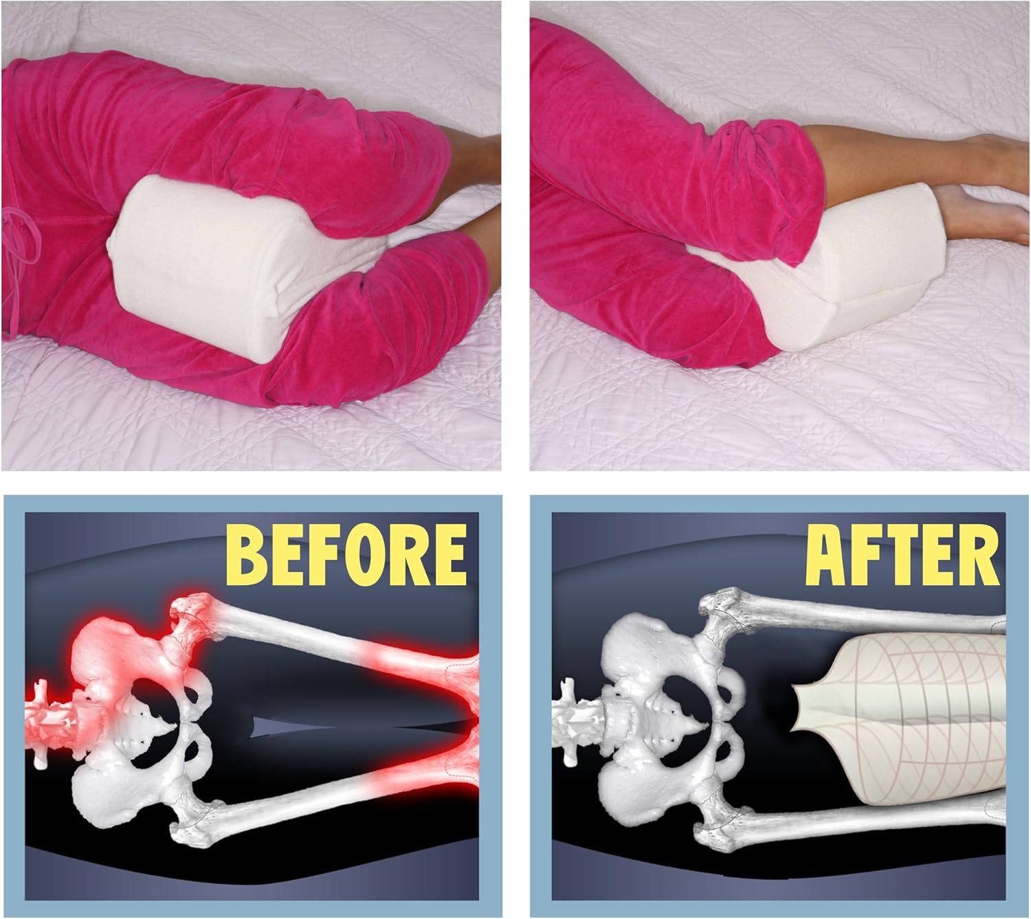 Deluxe Comfort Leg Spacer Pillow (21" x 7.5" x 4") - Hypo Clean and Soft Memory Foam - Medical Specialty Pillow - Side Sleeper - Leg Positioner Pillow, Natural: Home & Kitchen