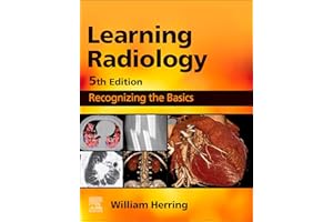 Learning Radiology E-Book