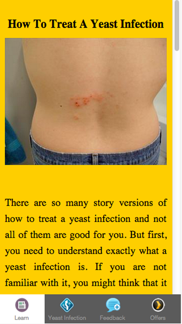 How To Treat A Yeast Infection - Thumbnail 3