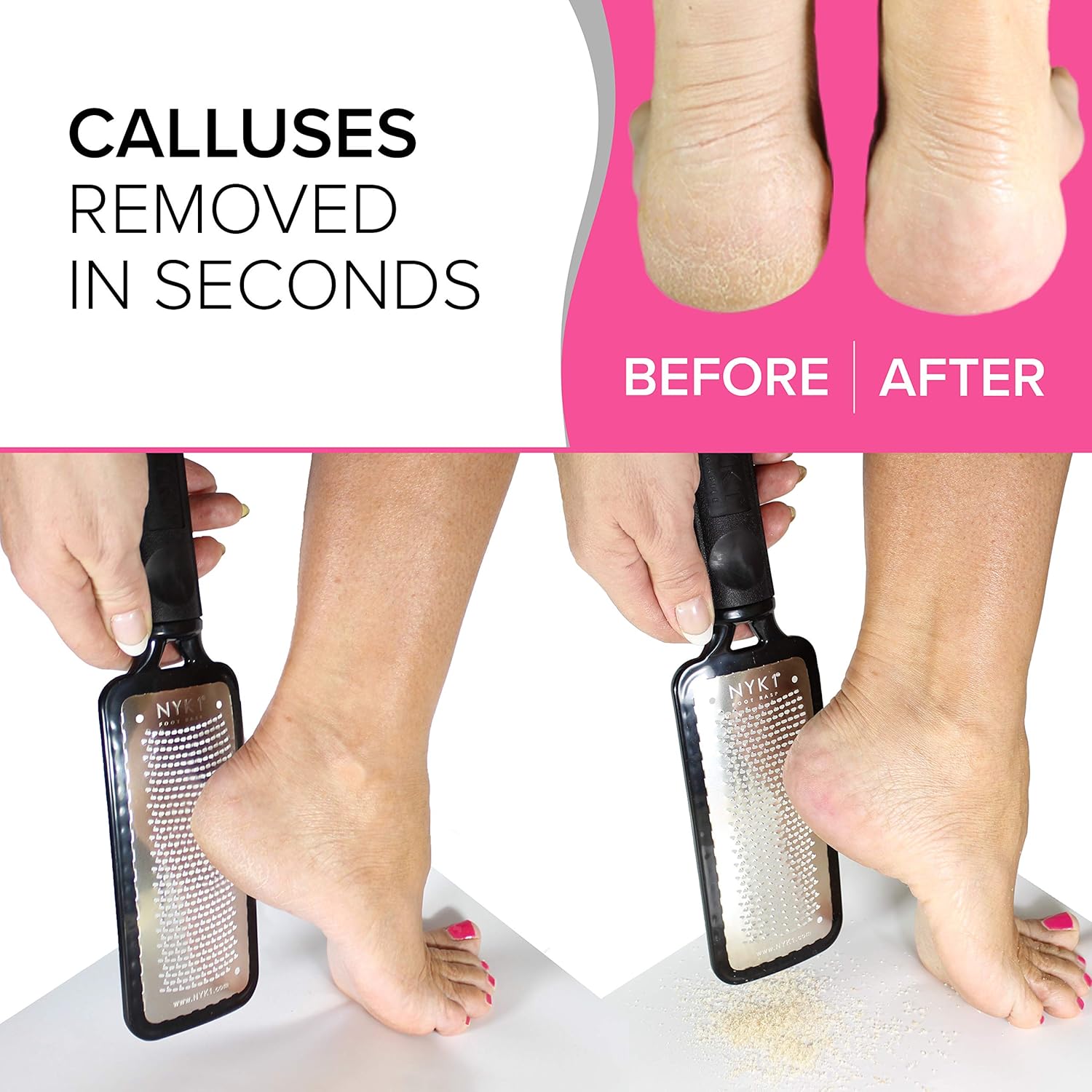 ULTIMATE Foot Rasp Foot Scrubber - Mega Foot File Dead Skin Remover Dead Skin Grater For Dry Hard Skin Feet, Professional Grater MEGAFILE Egg Ped Pedi Pumice Stone Foot File Callus Remover : Beauty