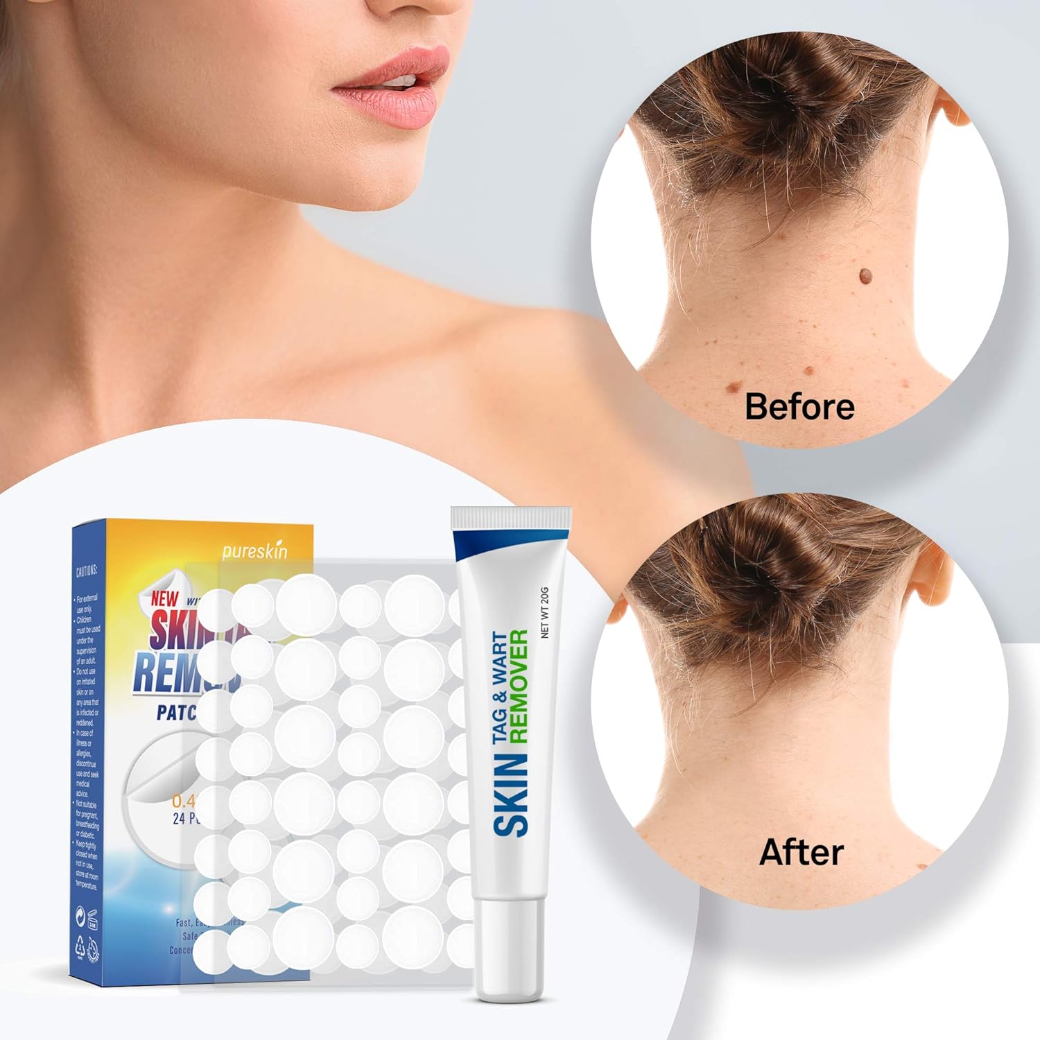 Pureskin Safe & Effective Formula Skin Tag Remover Patches Set, Skin Tag Removal Patches Set with Natural Ingredients for Your Skin Tag: Health & Personal Care