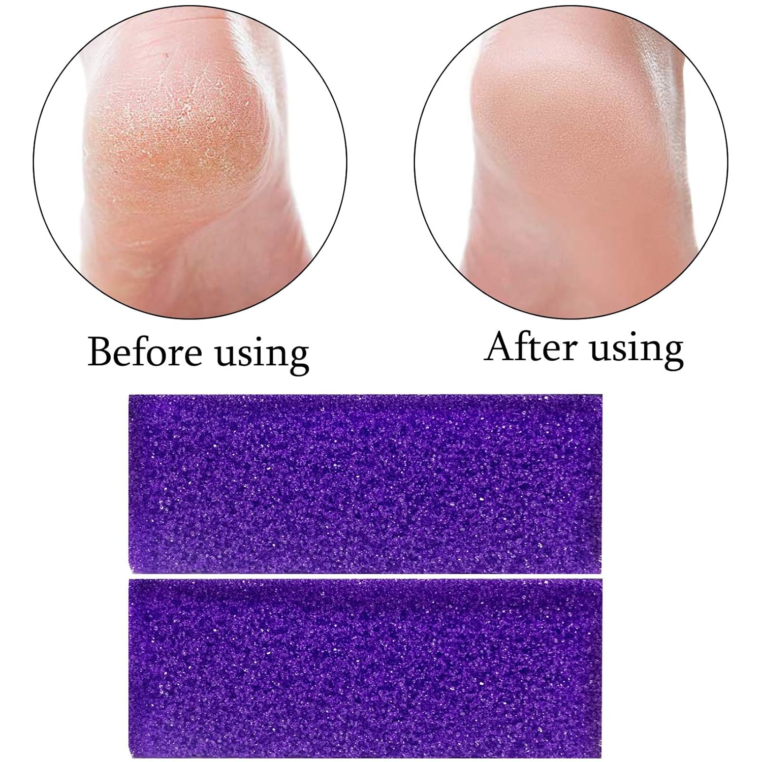40 Pcs Pumice Stone For Feet Foot Scrubber Sponge For Feet Care and Callus Remover Mini Disposable Pumice Pads For Dead Skin Remover Purper.: Beauty