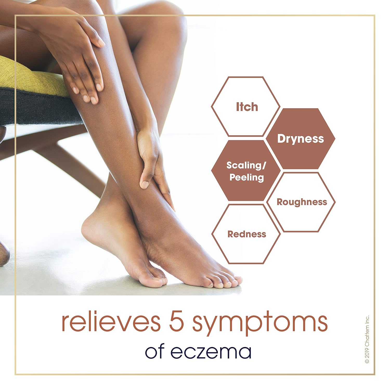 Gold Bond Eczema Relief, 14 Ounce : Beauty