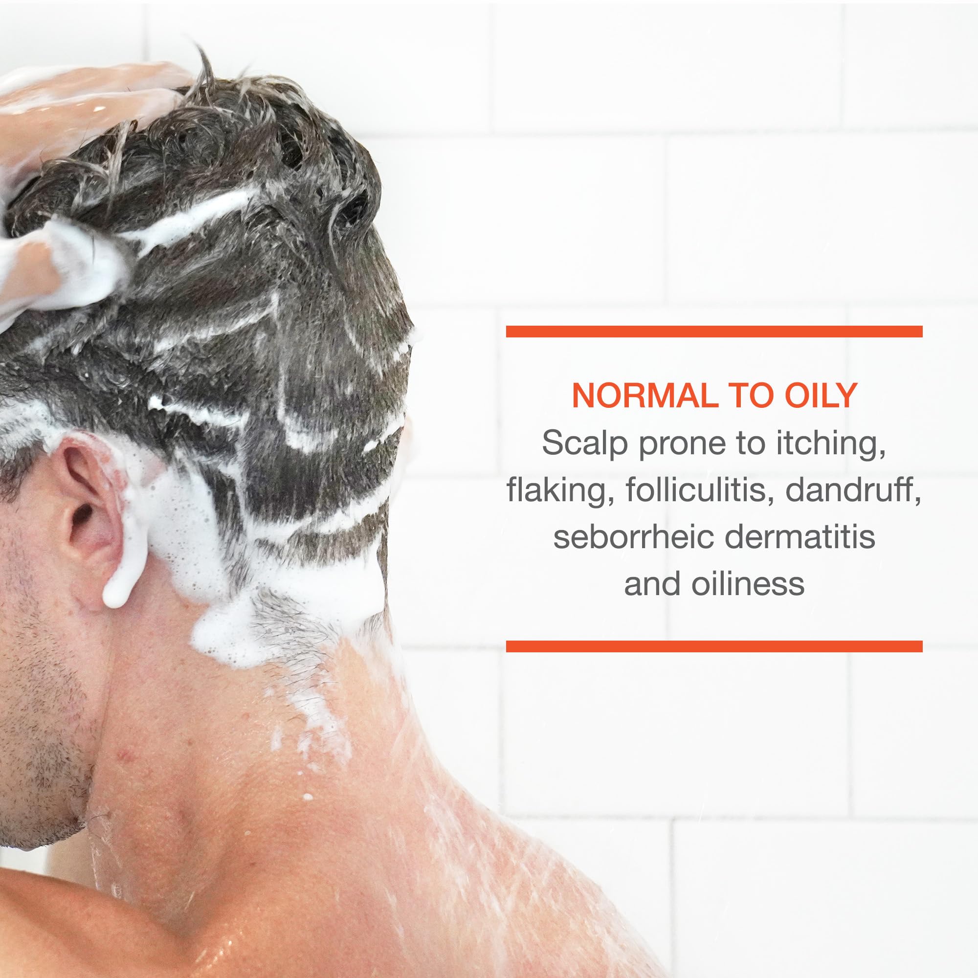 CLn® Shampoo - Clarifying Formula with Salicylic Acid, for Normal to Oily Scalp Prone to Folliculitis, Dandruff, Itchy & Flaky Scalp, Fragrance-Free & Paraben-Free, 8 fl. oz.