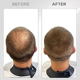 THICK FIBER Hair Fibres Medium Brown 25g Bottle for Thinning Hair view 7