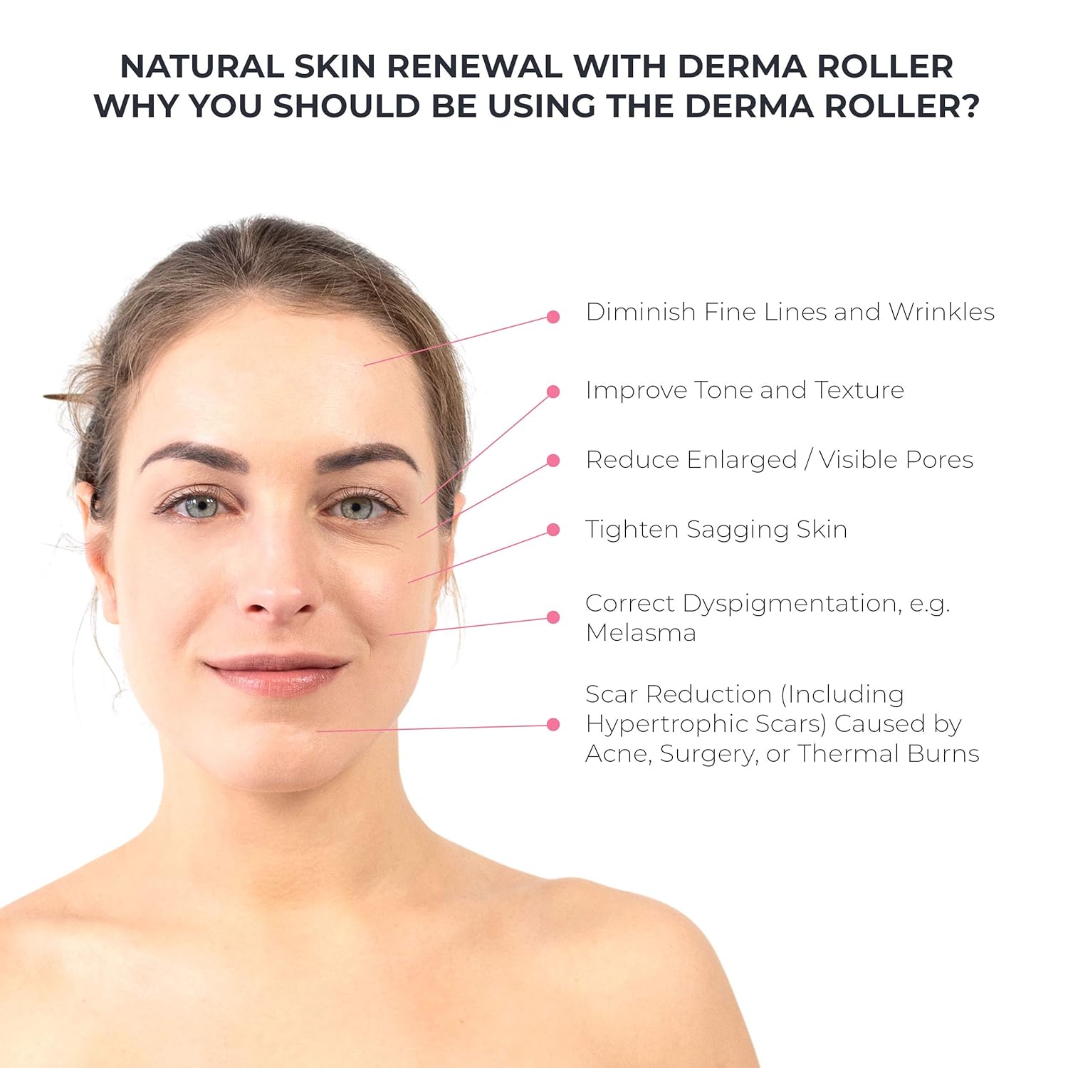 Derma Roller Cosmetic Microdermabrasion Device Tool for Face 0.25mm - Facial Roller 540 Titanium Micro Needles, Skin Roller For Home Skincare Use - Includes Free Storage Case + Free Ebook: Beauty