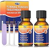 Toenail Fungus Treatment with 25% Undecylenic Acid: Toenail Fungus Treatment Extra Strength for Thick, Yellow and Damaged Nails - Safe and Gentle for Nails Care
