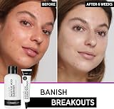 The INKEY List Breakout Recipe Salicylic Acid Clear Skin Starter Kit view 5