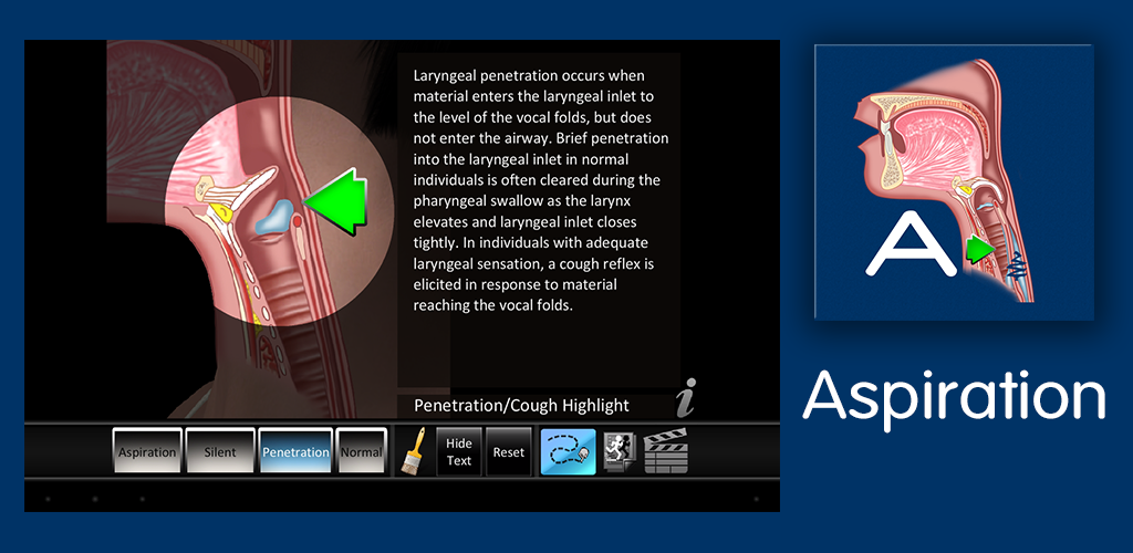 Aspiration Appstore for Android
