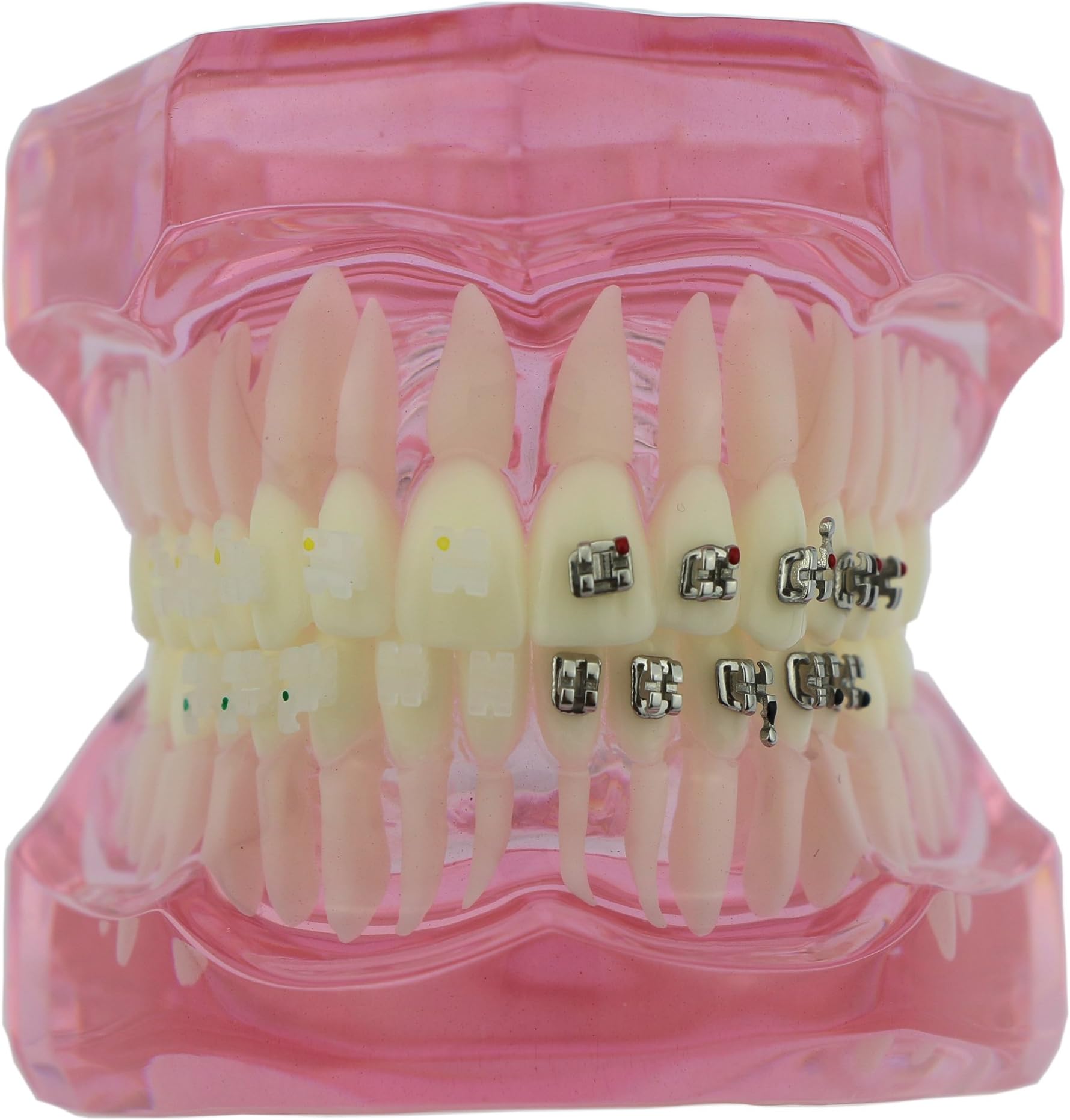 Dental Orthodontics Study Model with Ceramic and Metal Brackets 3003P