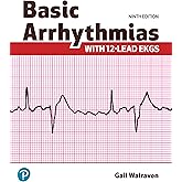 Basic Arrhythmias With 12-Lead EKGs