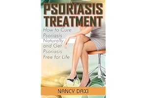 Psoriasis Treatment: How to Cure Psoriasis Naturally And Get Psoriasis-Free For Life (Psoriasis, Psoriasis free for life, Pso