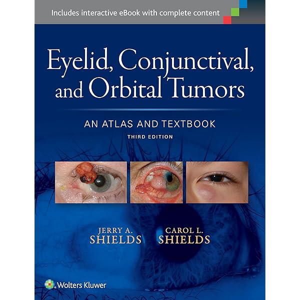 Atlas of Oculoplastic and Orbital Surgery: 9781496390813