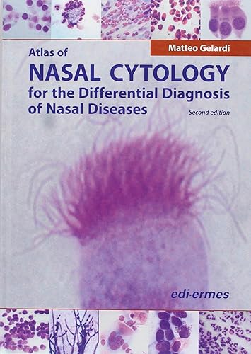 Download Atlas of Nasal Cytology: For the Differential Diagnosis of Nasal Diseases PDF