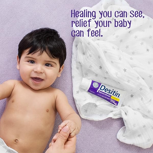 DESITIN MAXIMUM STRENGTH BABY DIAPER RASH CREAM, 40% ZINC OXIDE, HYPOALLERGENIC NO ADDED PARABENS & DYES, PROTECTS & RELIEVES BABY’S SKIN FOR UP TO 12 HOURS, PREVENTS DIAPER RASH, 4.8 OZ TUBE