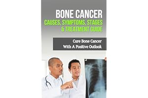 Bone Cancer Causes, Symptoms, Stages & Treatment Guide: Cure Bone Cancer With A Positive Outlook