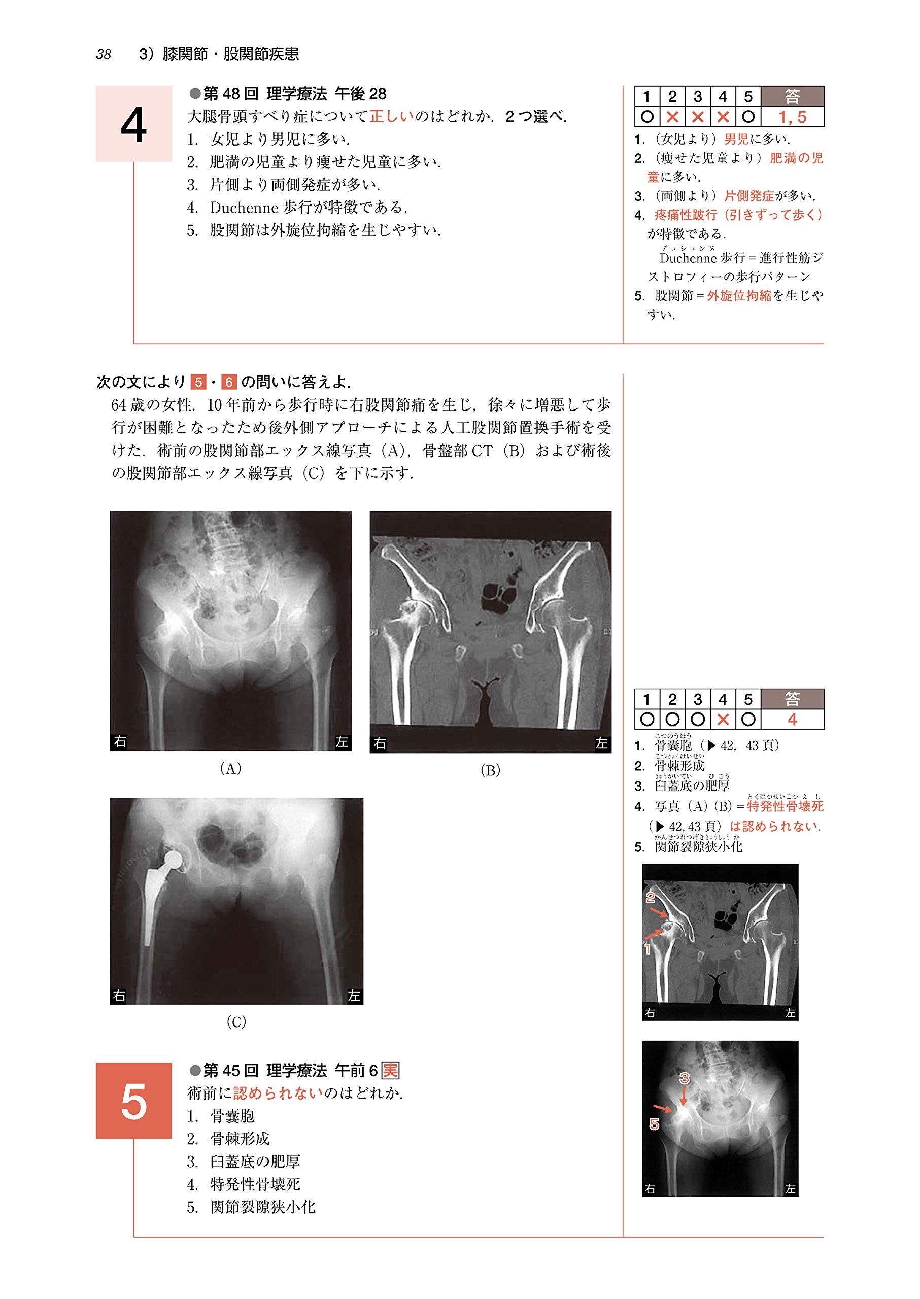 理学療法士 作業療法士国家試験必修ポイント 障害別pt治療学 2019 電子版 オンラインテスト付 9784263216408 Amazon Com Books