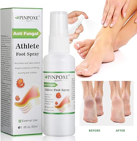 Athletes Foot Spray Antifungal Deodorant Antifungal Foot Spray Anti Fungi Treatment Of Athletes Foot And Ringworm Amazon Co Uk Health Personal Care