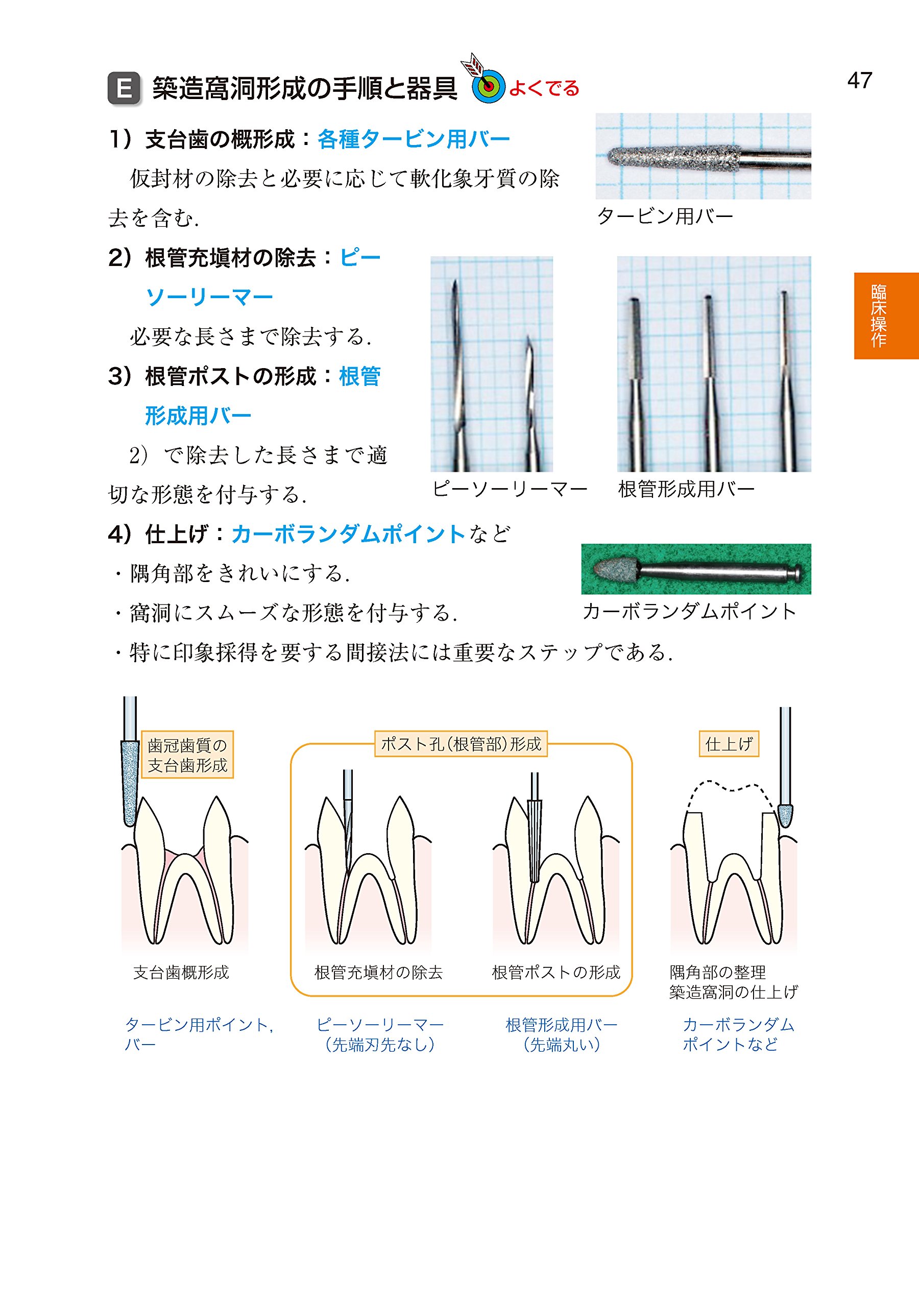 歯科国試パーフェクトマスター クラウンブリッジ補綴学 木本 克彦 星 憲幸 本 通販 Amazon