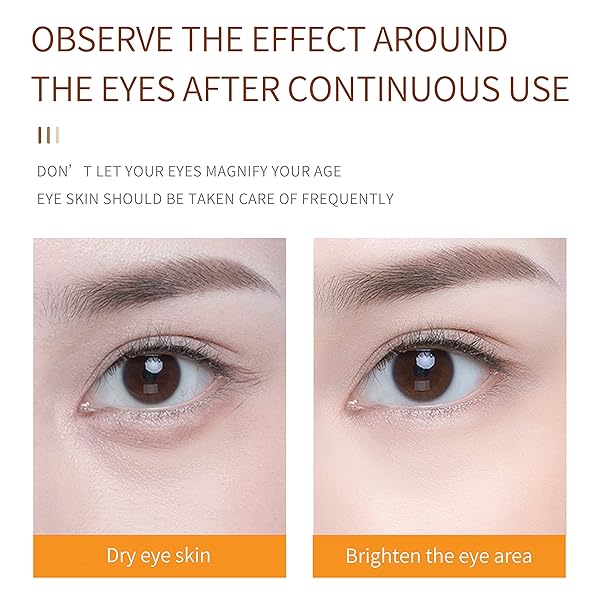 SULLMAR EYE CREAM EYE BAG TREATMENT FOR WOMEN EYE CREAM FOR WRINKLES EYE CREAM FOR WRINKLES AND DARK CIRCLES HYALURONIC ACID AND NIACINAMIDE FOR DARK CIRCLES AND PUFFINESS (VITAMIN C)