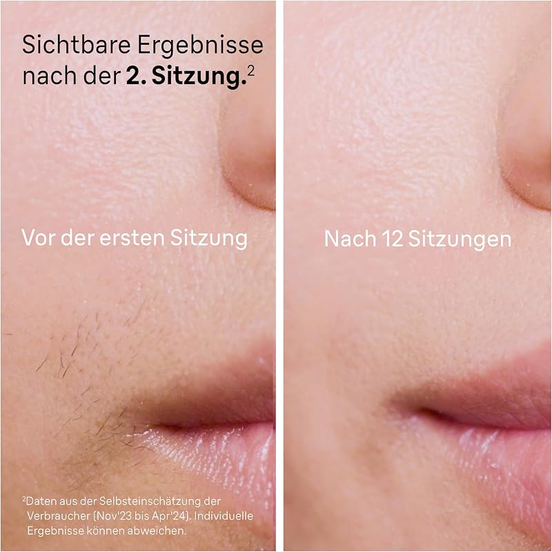 IPL Geräte Haarentfernung Silk·expert Pro 5, PL5140, Weiß/Gold