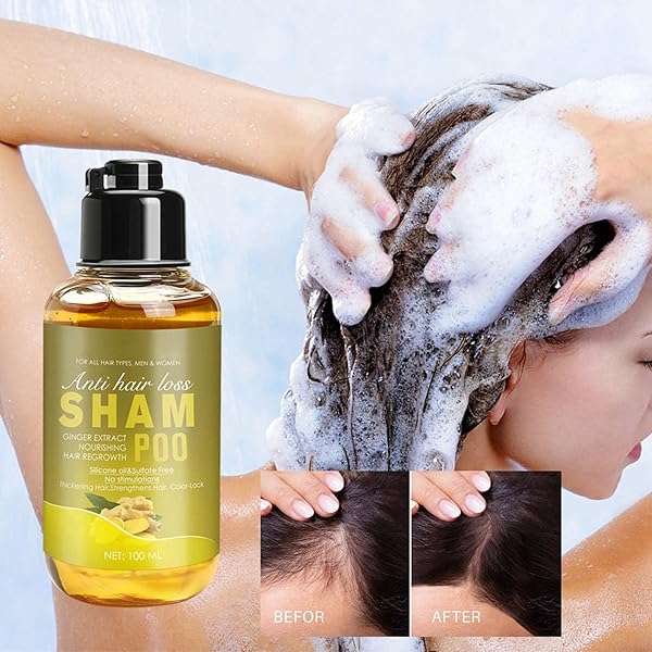 GINGER SHAMPOO, GINGER SHAMPOO FOR HAIR GROWTH, GINGER ANTI-FALL SHAMPOO, GINGER ANTI-HAIR LOSS HAIR SHAMPOO, GINGER HAIR REGROWTH SHAMPOO FOR THICKER, STRONGER, SMOOTHER, AND MORE GLOSSY HAIR