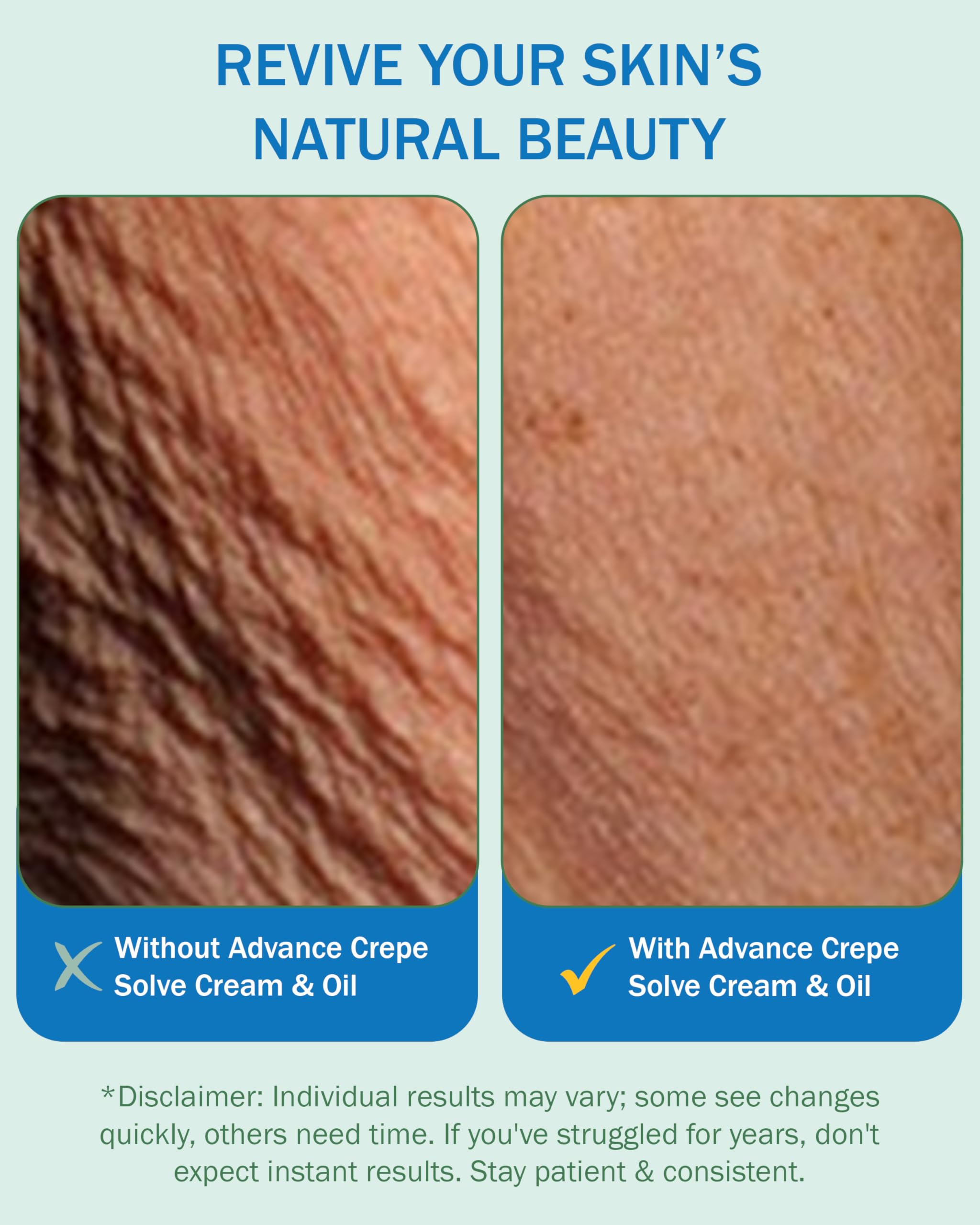 Crepe Cream & Firming Oil Crepe Skin Set, Women & Men - with Natural Oils, Licorice Root & Chamomile Extract - Crepey Skin Tightening Cream & Oil for Body, Made in USA