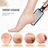 BRITS N STUFF 3 PCS Pedicure Foot File - Anti Rust Callus Remover view 7