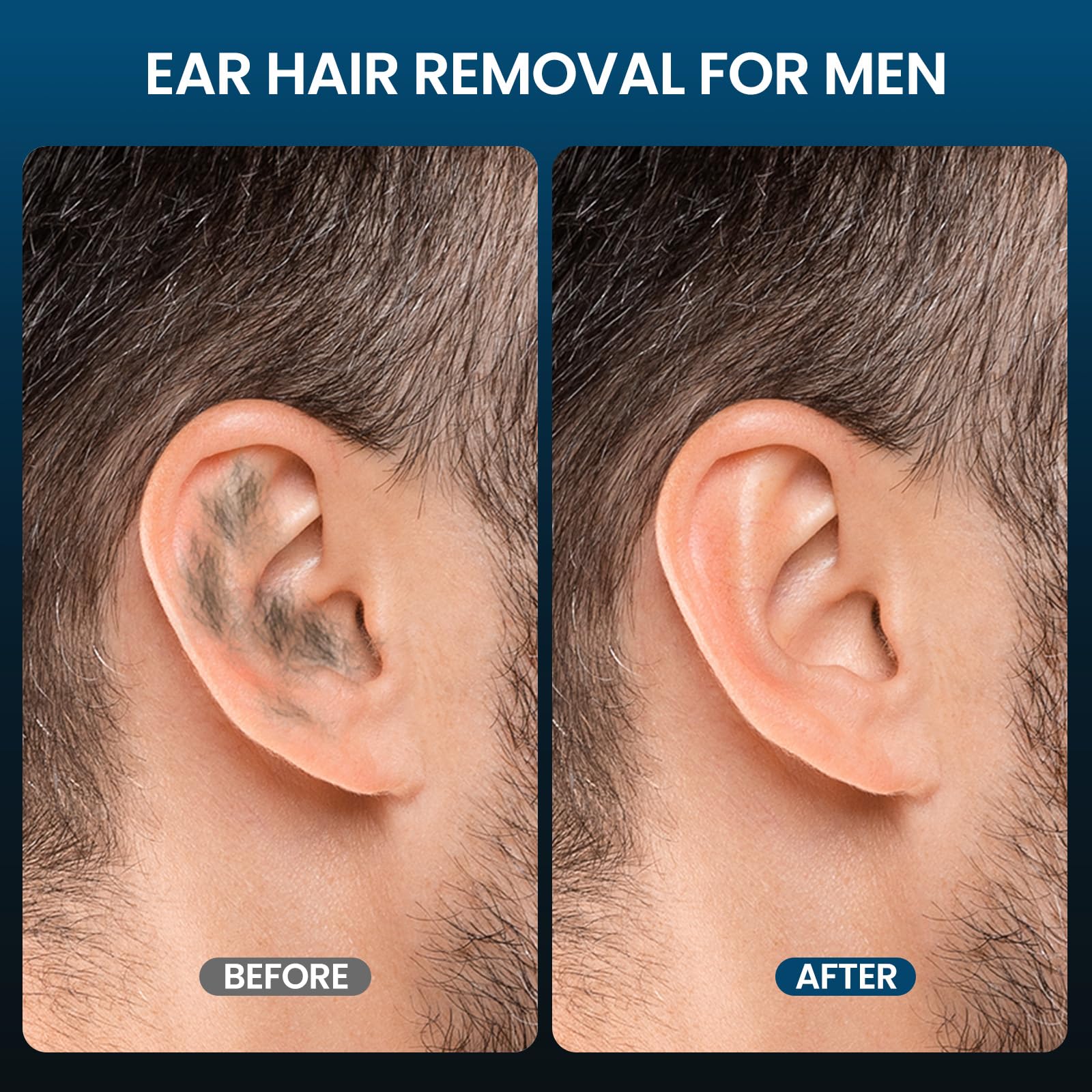 AUZEAL Nose Wax Kit Men, Ear Hair Removal For Men, Ear Hair Waxing Kit with 100 g Wax, 40 Nose Sticks, 20 Times Use, Usb Rapid Heating, Constant Temperature, Painless, Black