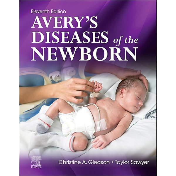 Amazon.com: Volpe's Neurology of the Newborn E-Book eBook : Volpe