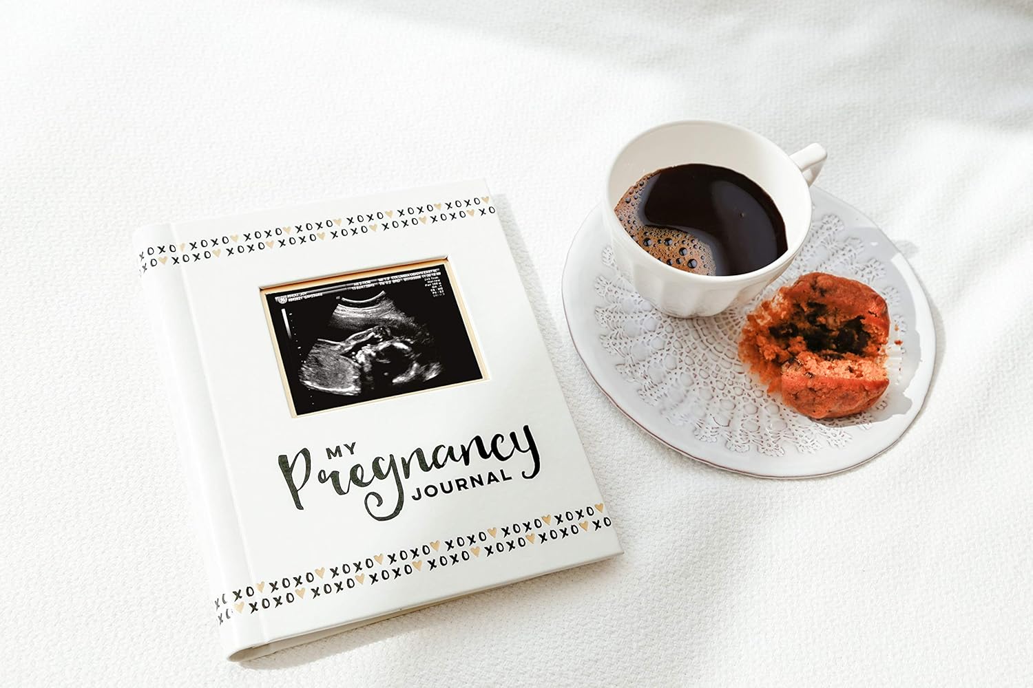 Pearhead My Pregnancy Journal, Pregnancy Book, Capture Every Precious Moment of Your Pregnancy, Gift for New Mom : Baby