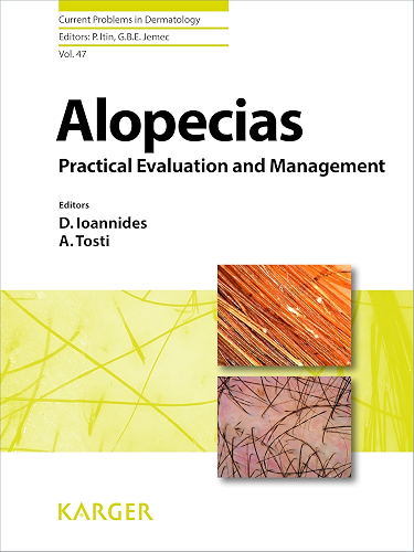 Download Alopecias - Practical Evaluation and Management (Current Problems in Dermatology Book 47) (English Edition) PDF