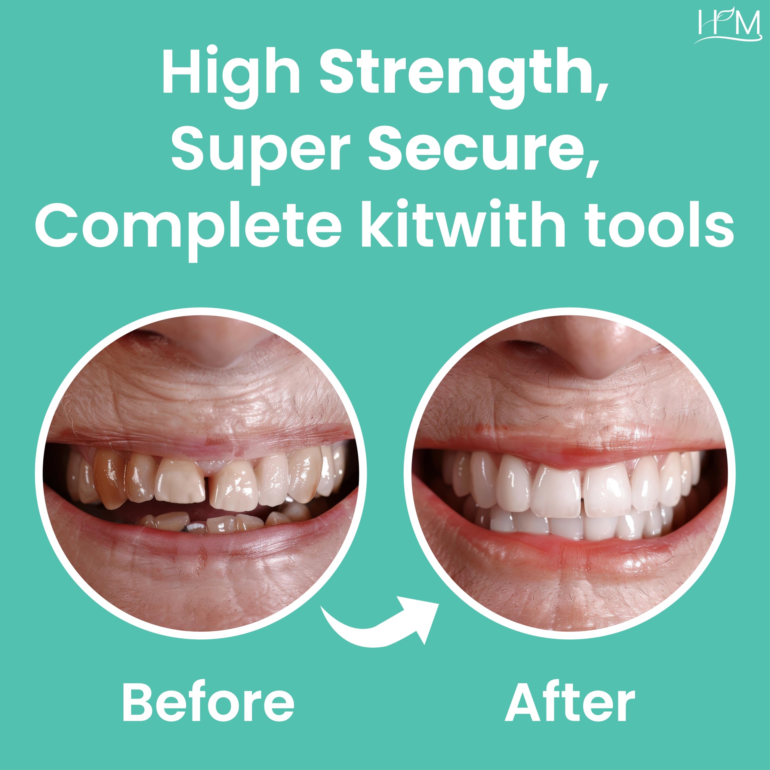 HM Zinc Oxide Eugenol Dental Cement Kit | Super Adhesive | Instant Tooth Repair, Cap, Crown & Bridge Filling | DIY, Self Curing, Sturdy & High Strength |Universal Shade| Emergency Dental Care | 1 Box