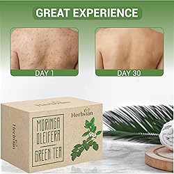 2 Pcs Moringa & Green Tea Soap Bars, Controlling