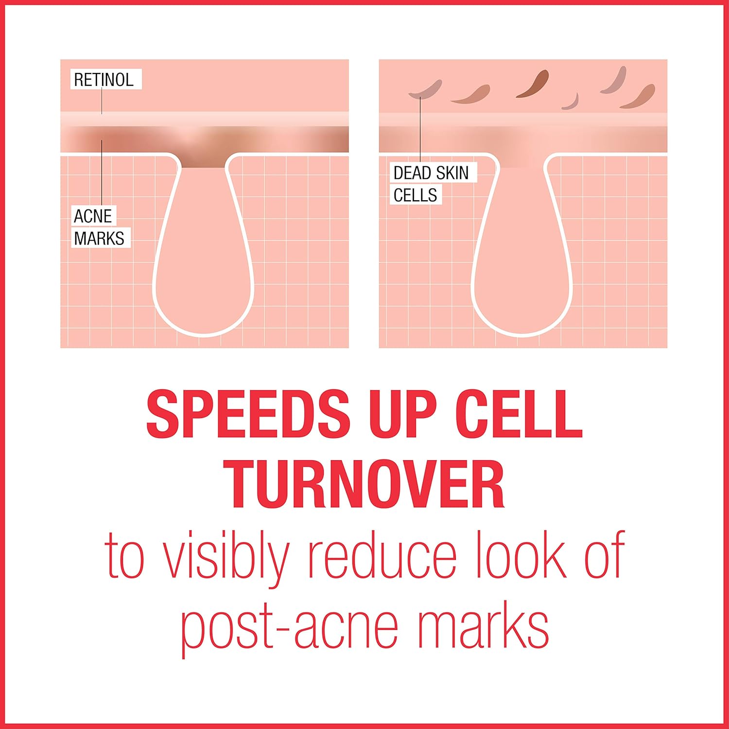 neutrogena stubborn marks