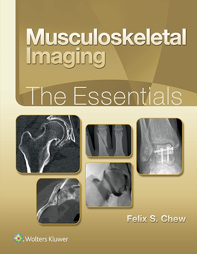 Download Musculoskeletal Imaging: The Essentials (English Edition) PDF