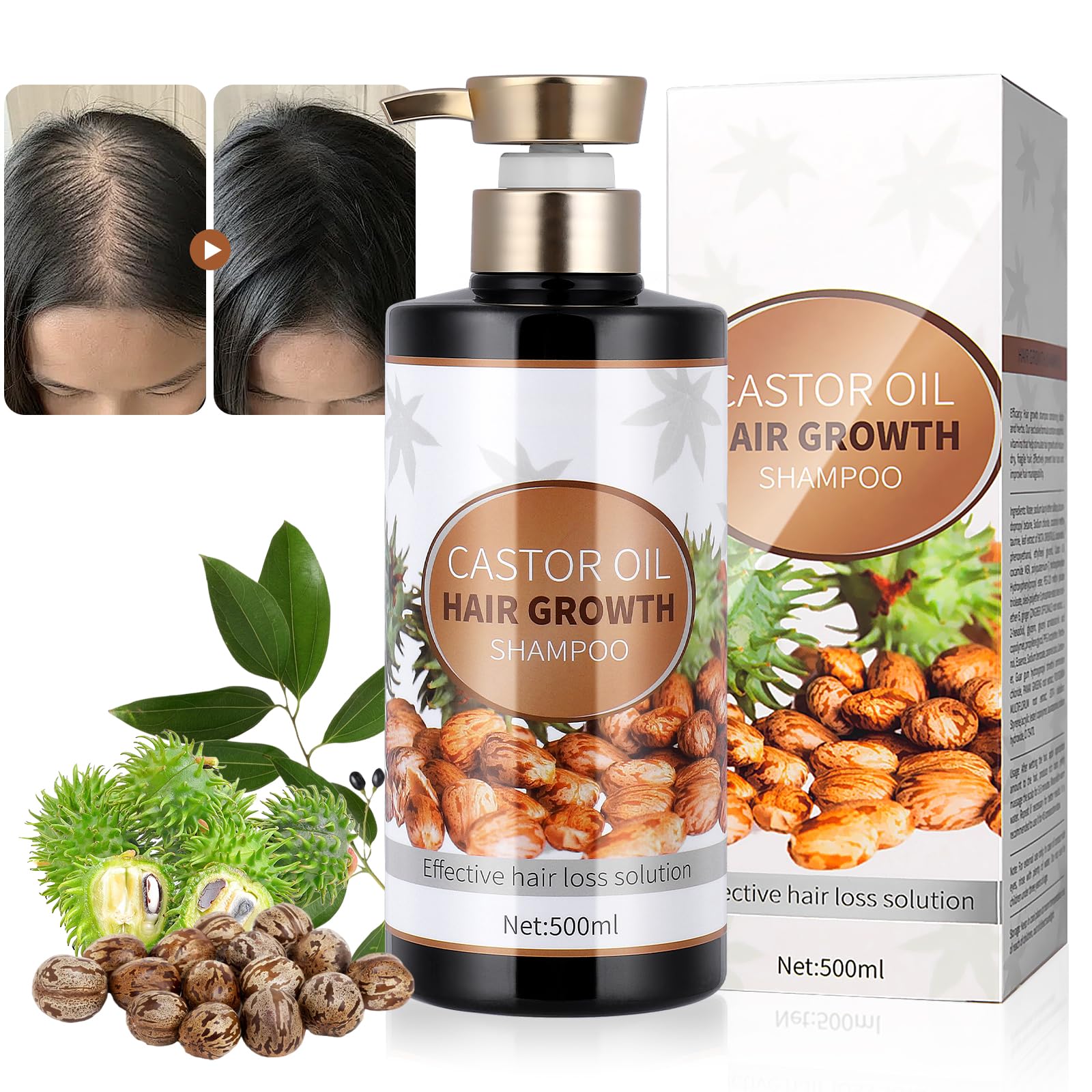 Castor Oil Hair Growth Shampoo Strengthens Roots, Prevents Loss and Thinning, Nourishes Dry Hair, Restores Smoothness for Women & Men, 16.91 fl.oz (1, Beige)