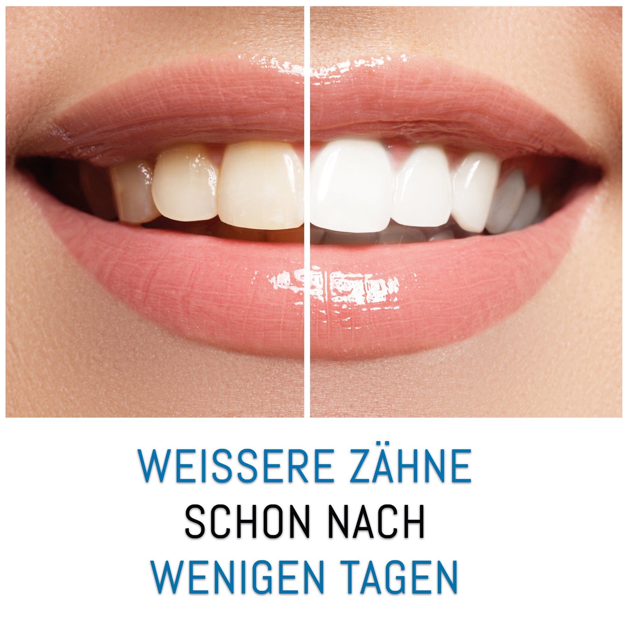 Premium Bleaching White Stripes - Schmerzfrei - Zweifacher Testsieger - Zähne Aufhellen - Zahnaufhellung Weiße Zähne
