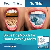 XyliMelts Dry Mouth Relief Discs Mild Mint 40 Count - Xylitol Adhering Tablets view 6