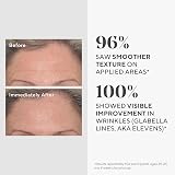 Murad Targeted Wrinkle Corrector Resurgence 15ml Anti-Wrinkle Cream view 3