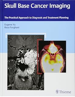 Amazon Radiology Case Review Series Msk Imaging Sayed - 
