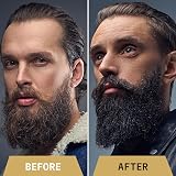 Striking Viking Beard Oil for Men 2 Fl Oz Citrus Scent Natural Conditioner view 7