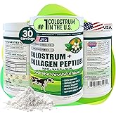 OVIDA Premium Bovine Colostrum and Collagen Peptides - Grass-Fed, Non-GMO, Gut Health, Immune Support, Joint & Bone Health Support, Hair Growth & Skin Beauty Supplement, Unflavored, 300g, 30 Servings