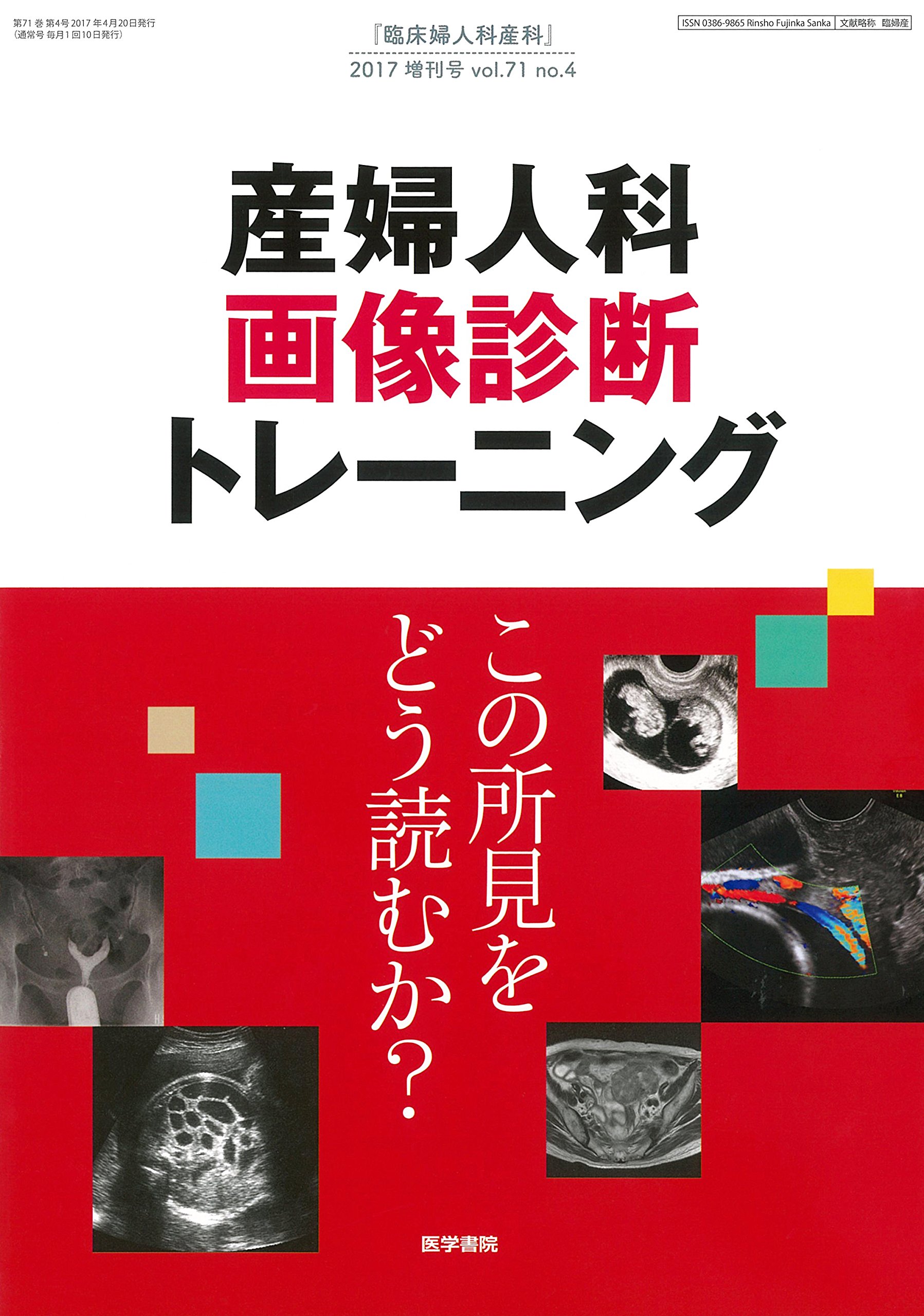 臨床婦人科産科 2017年 4月号増刊号 産婦人科画像診断トレーニング この所見をどう読むか 4910093300474 Amazon Com Books