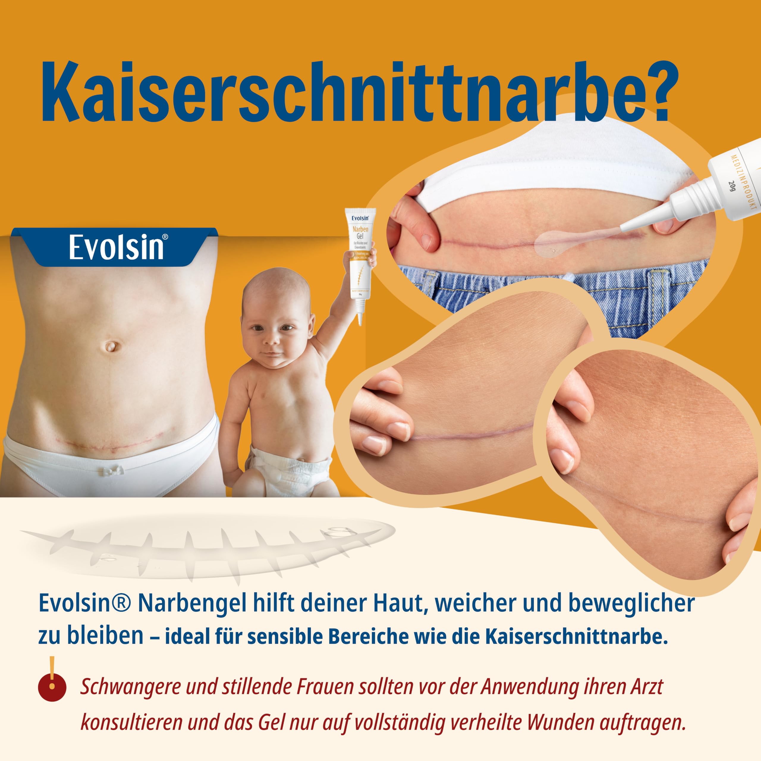 Evolsin® Narbengel für Kinder & Erwachsene, 20 g 9