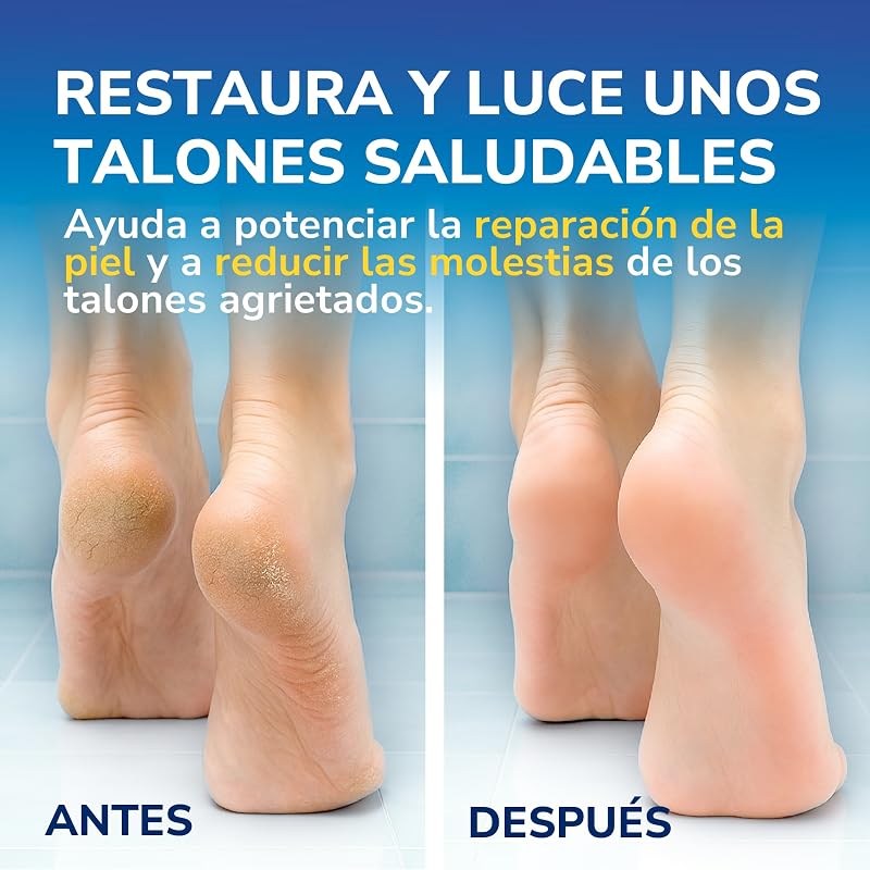 Scholl Crema de Pies para Talones Agrietados, con Urea y Keratina, Blanco, 60 Mililitros, 6